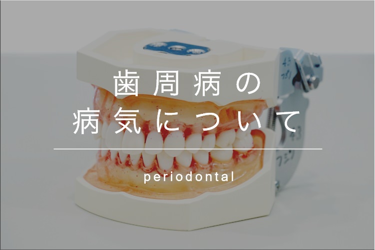 歯周病の病気について periodontal